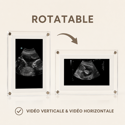 TinyView™