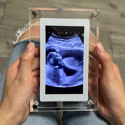 TinyView™